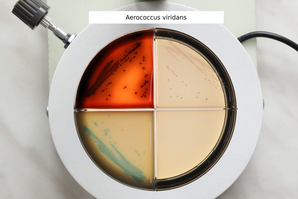 Aerococcus viridans