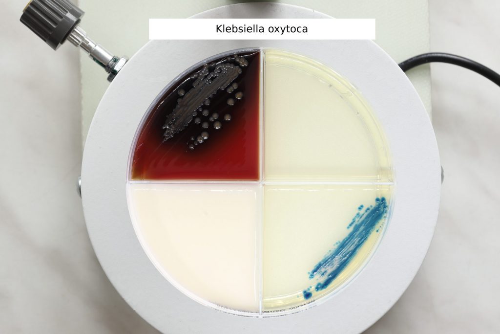 Klebsiella oxytoca