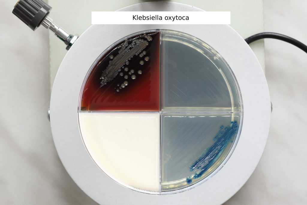 Klebsiella oxytoca