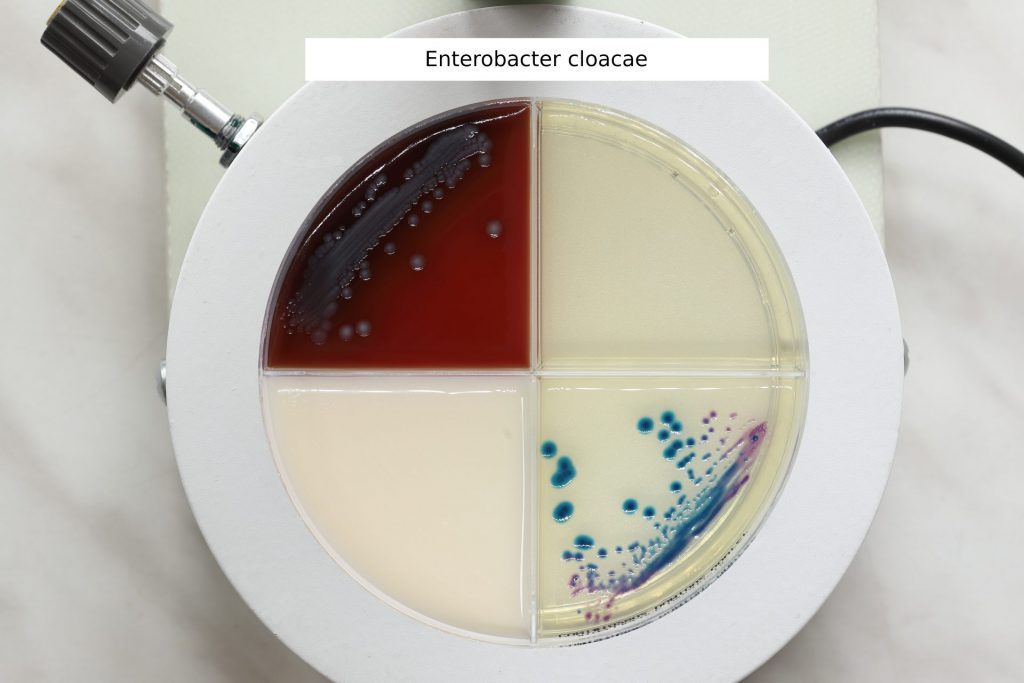 Enterobacter cloacae