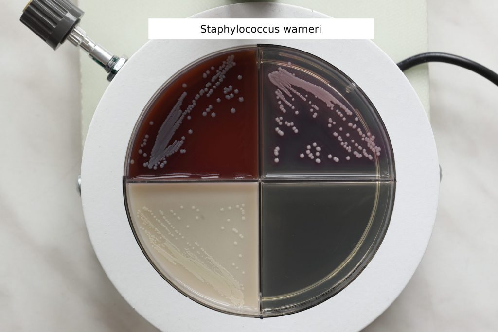 Staphylococcus warneri