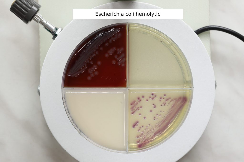Escherichia coli hemolytica