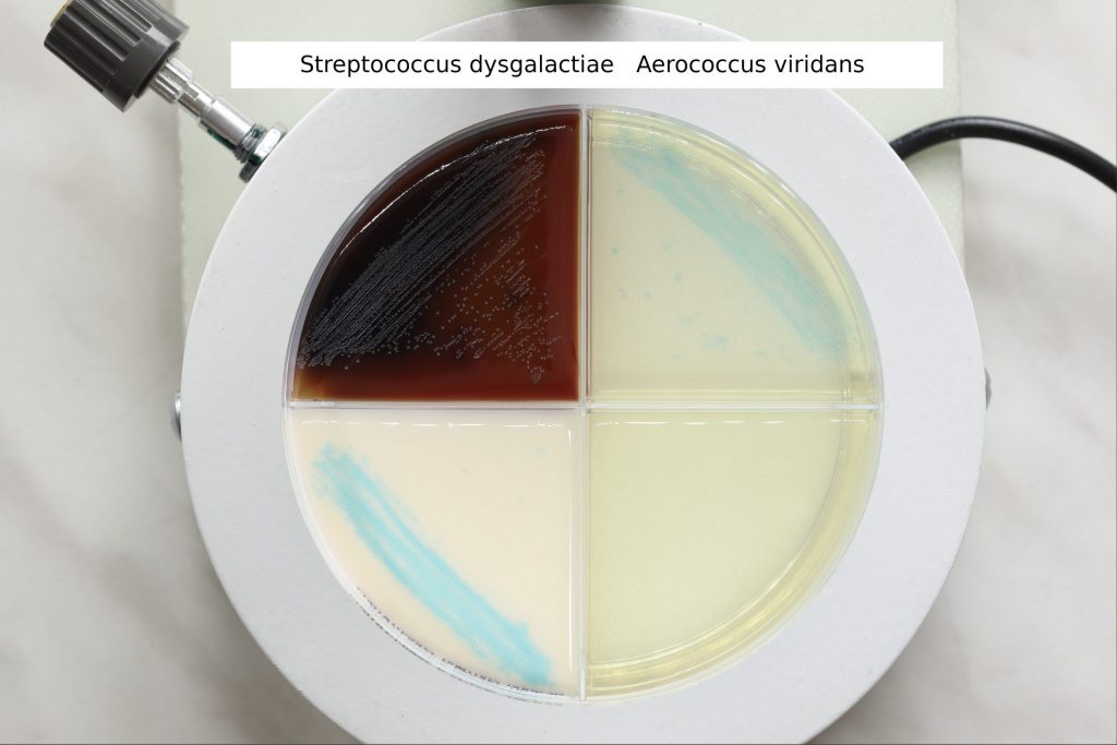 Streptococcus dysgalactiae