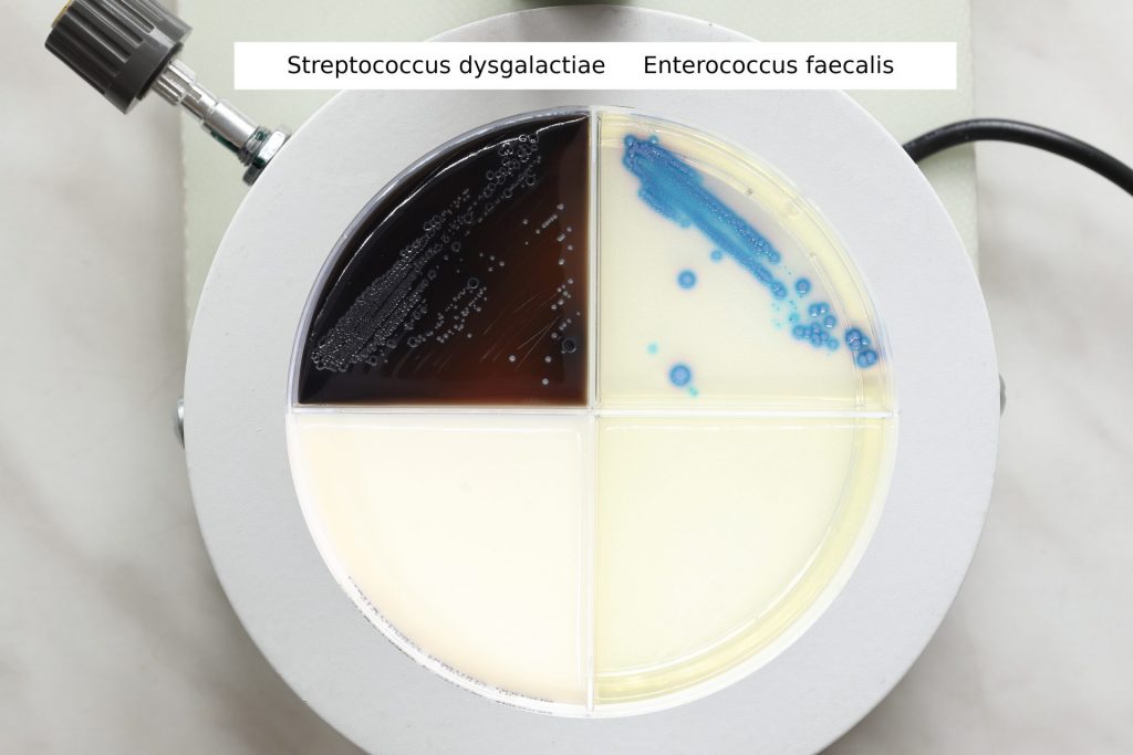 Streptococcus dysgalactiae